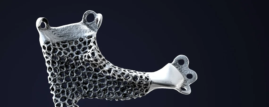 Additive Manufacturing Meets Medical Implants