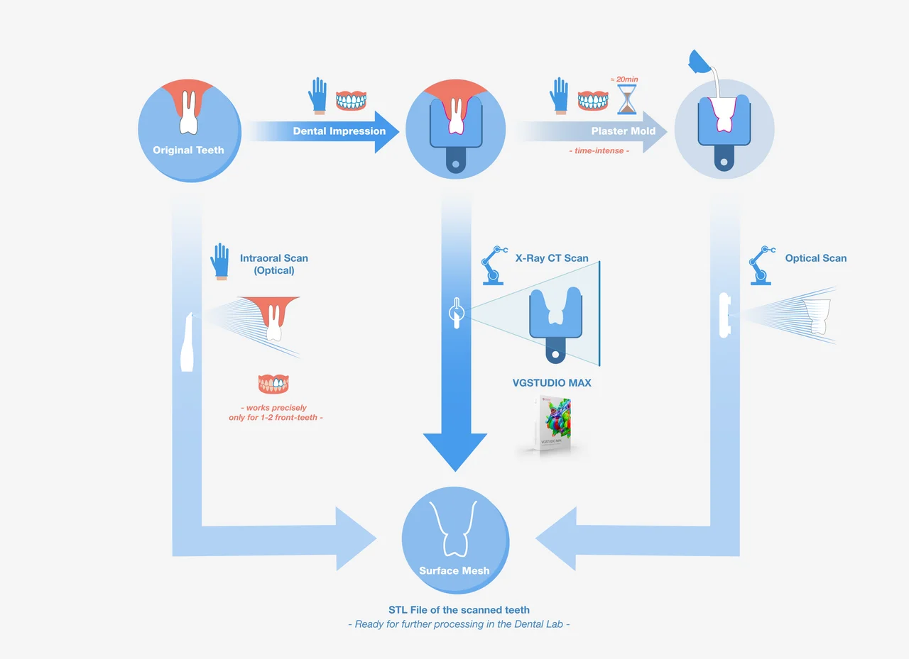 Chart showing different scanning methods to get an STL of scanned teeth (intraoral, X-Ray CT, and optical)