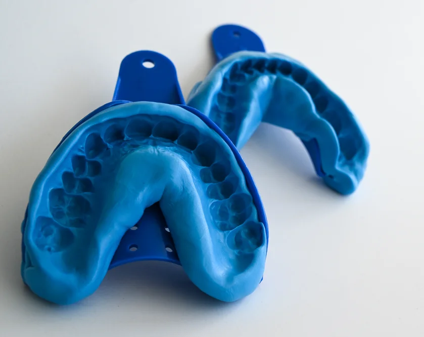 Classic dental impressions made using a special plaster in a horseshoe-shaped tray